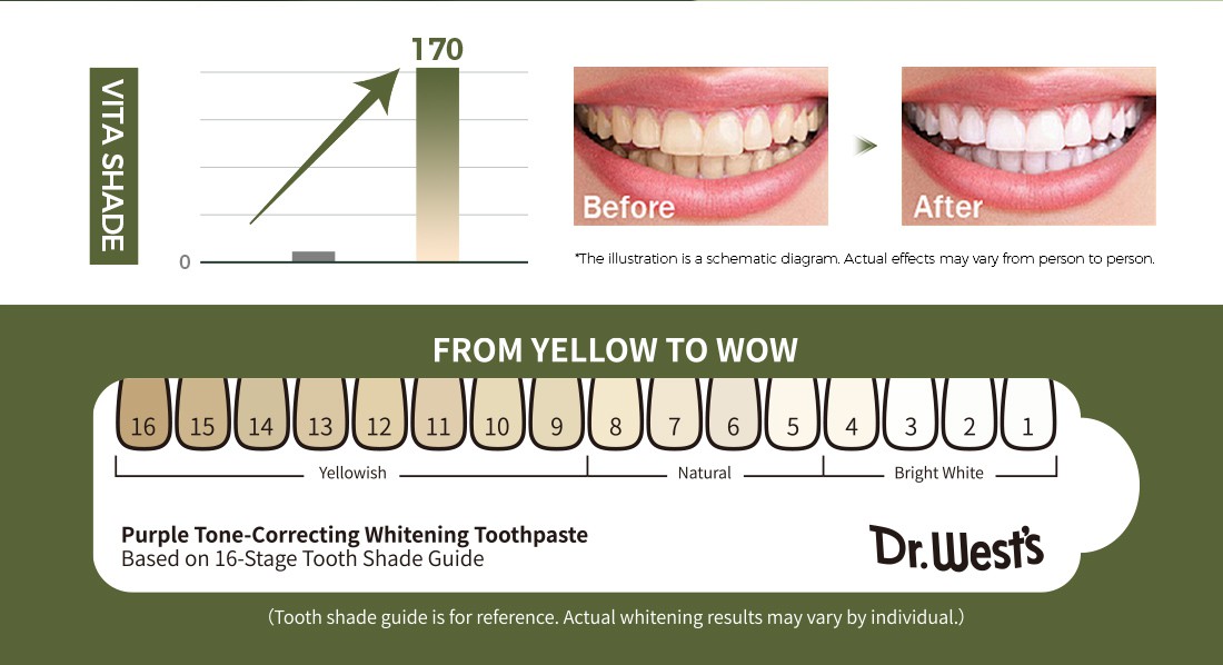 E-2025DW004 E-2025DW004